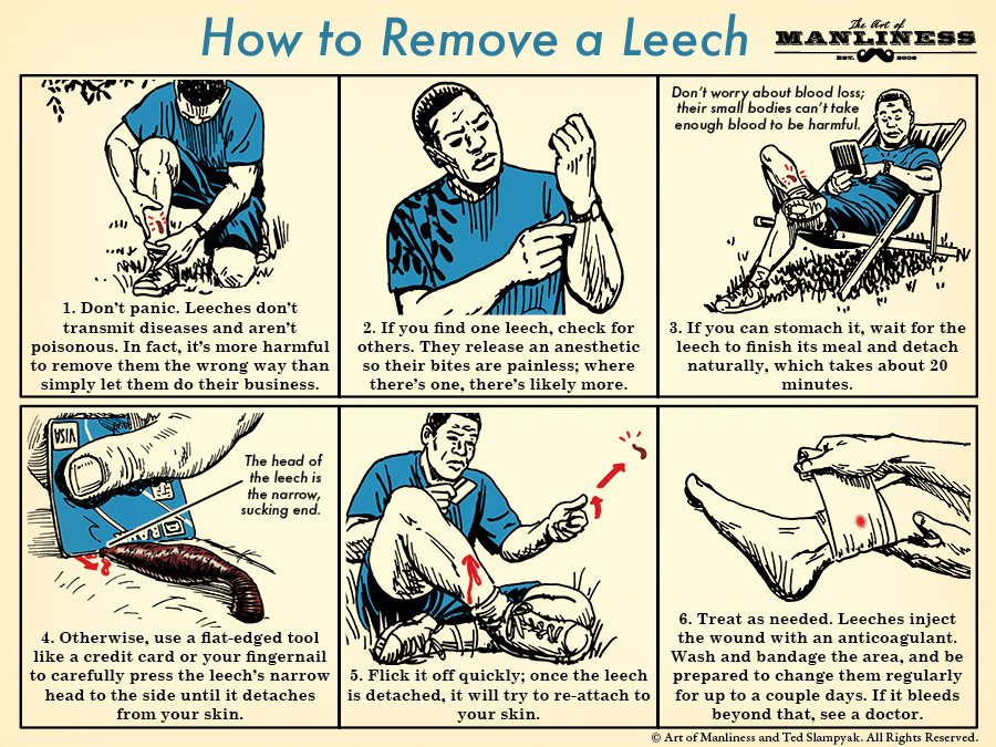 Remove-a-Leech-2